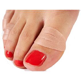 Sidas Toe Protector x5 blister 4.Image